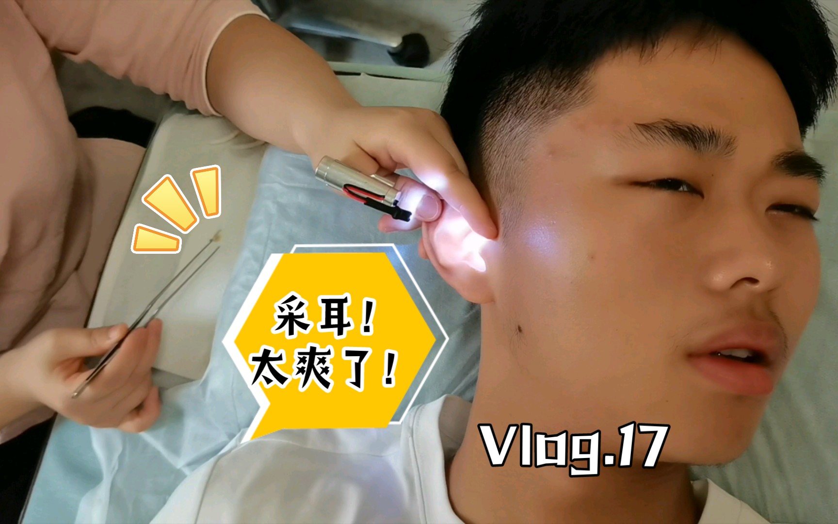 高一小弟弟耳结取出全过程,舒适采耳