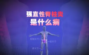 Descargar video: 李宇春患的“强直性脊柱炎”：为何偏好年轻人？