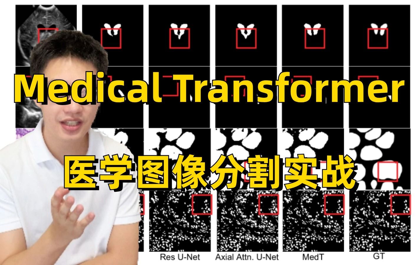 【强到离谱】Transformer到底有多牛?SwinUnet:基于Transformer的医学图像分割实战,迪哥手把手带你精读论文并复现源码!哔哩哔哩bilibili