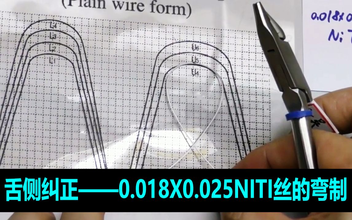 舌侧矫正0.018X0.025镍钛丝的弯制正畸弓丝的弯曲的精细制作哔哩哔哩bilibili