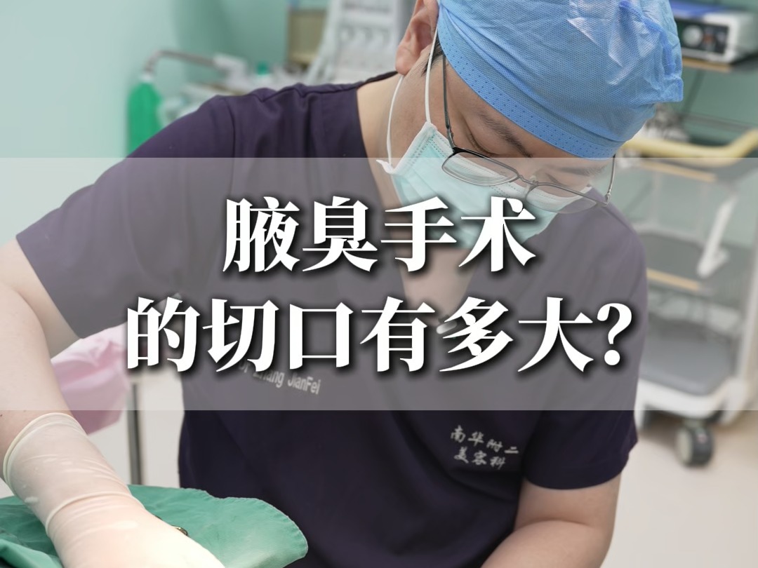 腋臭手术的切口有多大?哔哩哔哩bilibili