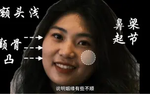 下载视频: 你见过“长胡须”的女人吗？