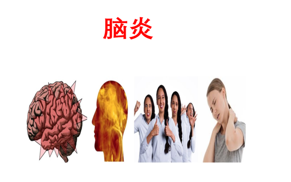 【医学科普】脑炎 实质受累 神经内科 双语实用内科学课程系列哔哩哔哩bilibili