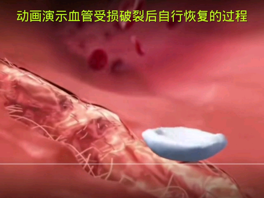血管受损破裂后自行恢复的过程，