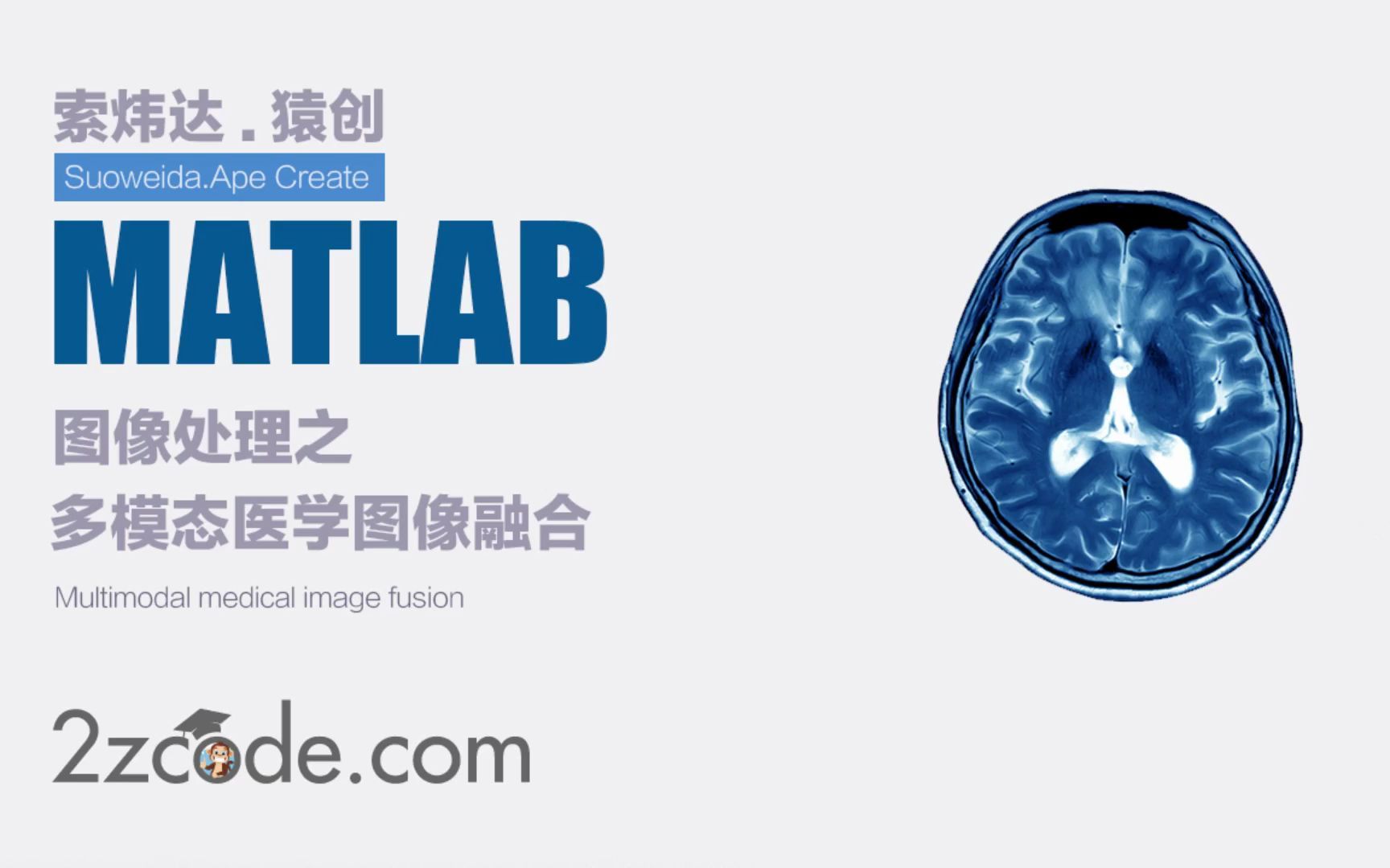 基于Matlab离散小波变换的多模态医学图像融合哔哩哔哩bilibili