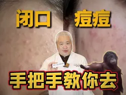 Download Video: 【科普】一支药膏，轻松那些额头闭口痘痘！！