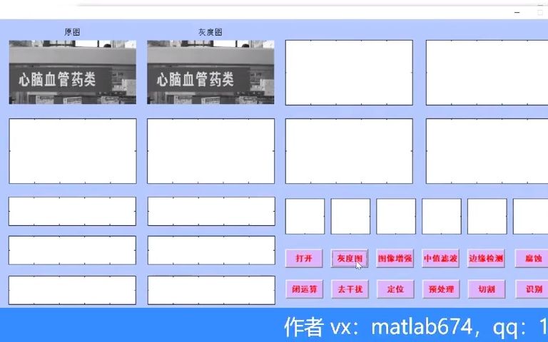 MATLAB设计复杂背景文本汉字识别[Vx是matlab674](原生态开发)哔哩哔哩bilibili