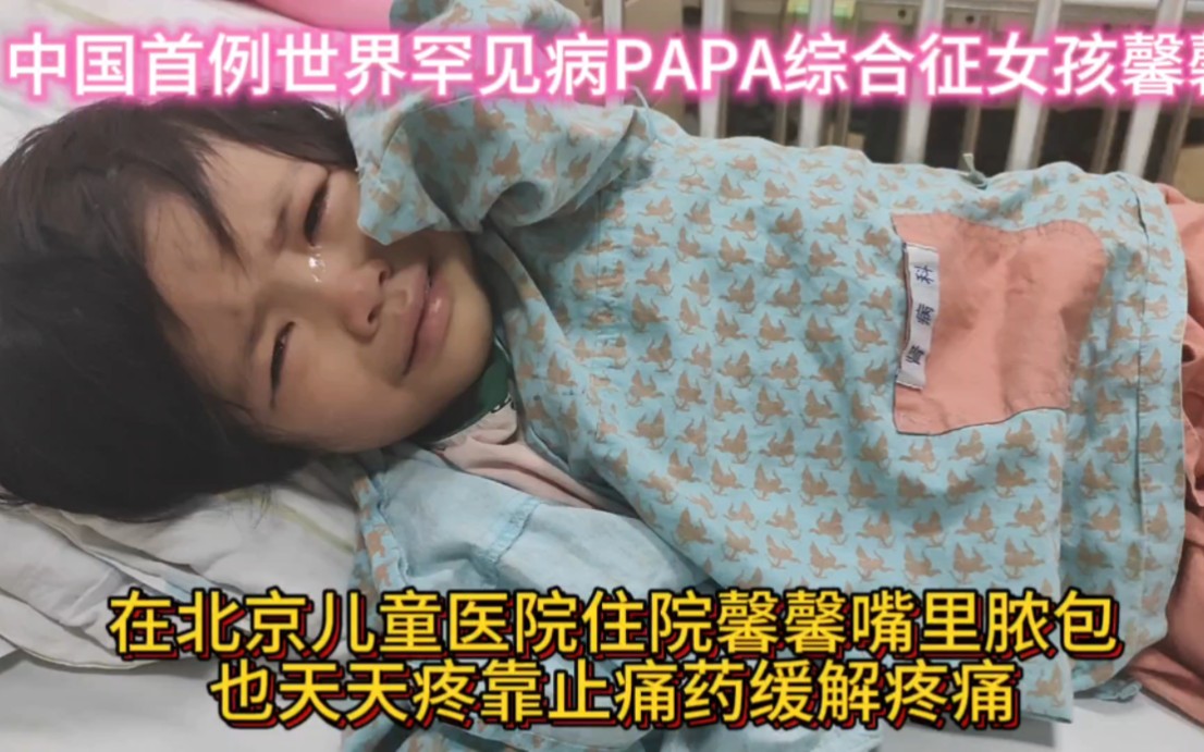 中国女童馨馨患世界罕见病PAPA综合征,在重医儿童医院确诊的,目前再北京儿童医院住院治疗,可是每天除了做不完检查.抽不完血,嘴疼打滚就不停换...