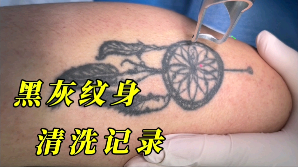 黑灰纹身 清洗记录
