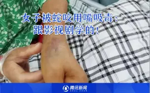 Download Video: 女子被蛇咬用嘴吸毒牙龈严重出血 ：跟影视剧学的