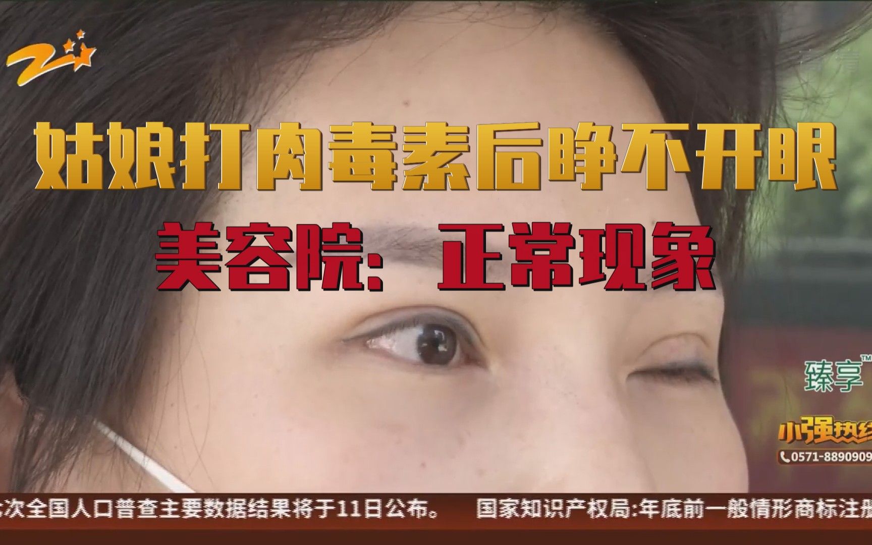 姑娘打肉毒素后眼睛睁不开 姑娘成"独眼" 美容院:正常现象_哔哩哔哩
