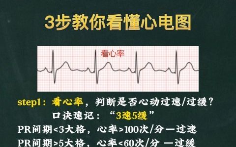 简单3步教你怎么看懂心电图?学医的必备哔哩哔哩bilibili