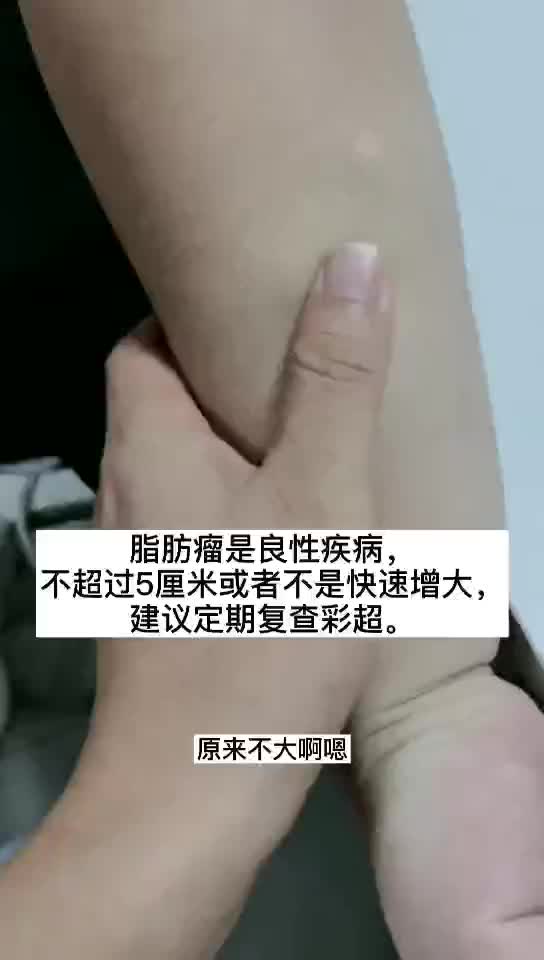 脂肪瘤是是否需要手术切除?哔哩哔哩bilibili