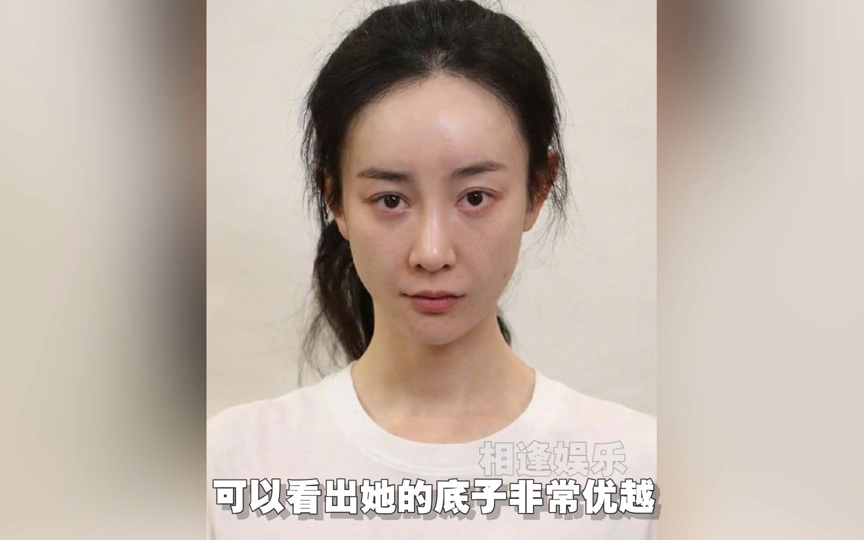 张檬节目中哭诉:活到现在最后悔的是整容,整容恢复失败悔不当初