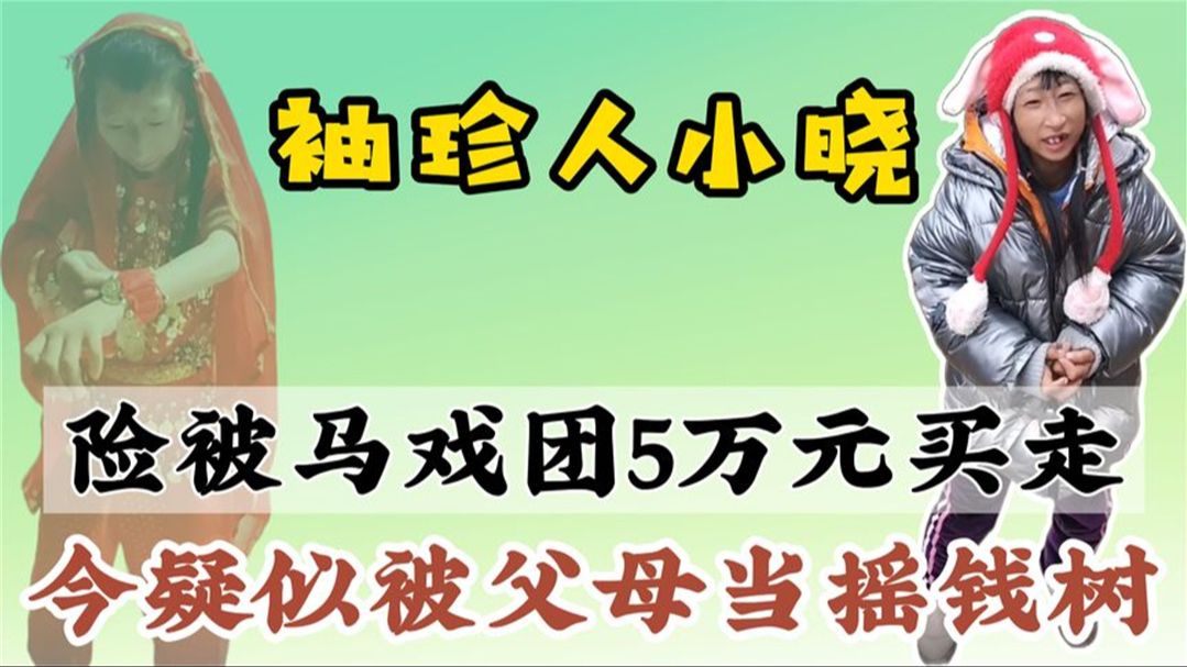 34岁袖珍人小晓高1.1米,从可怜人到全网唾骂,她经历了什么?哔哩哔哩bilibili