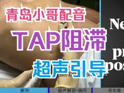 Tải video: 【麻醉技术】超声引导下腹横肌平面阻滞 TAP 青岛小哥配音 慢速0.8 双语字幕 翻译人工校对