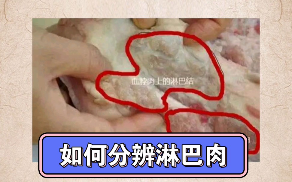 什么是淋巴肉?它有什么危害哔哩哔哩bilibili