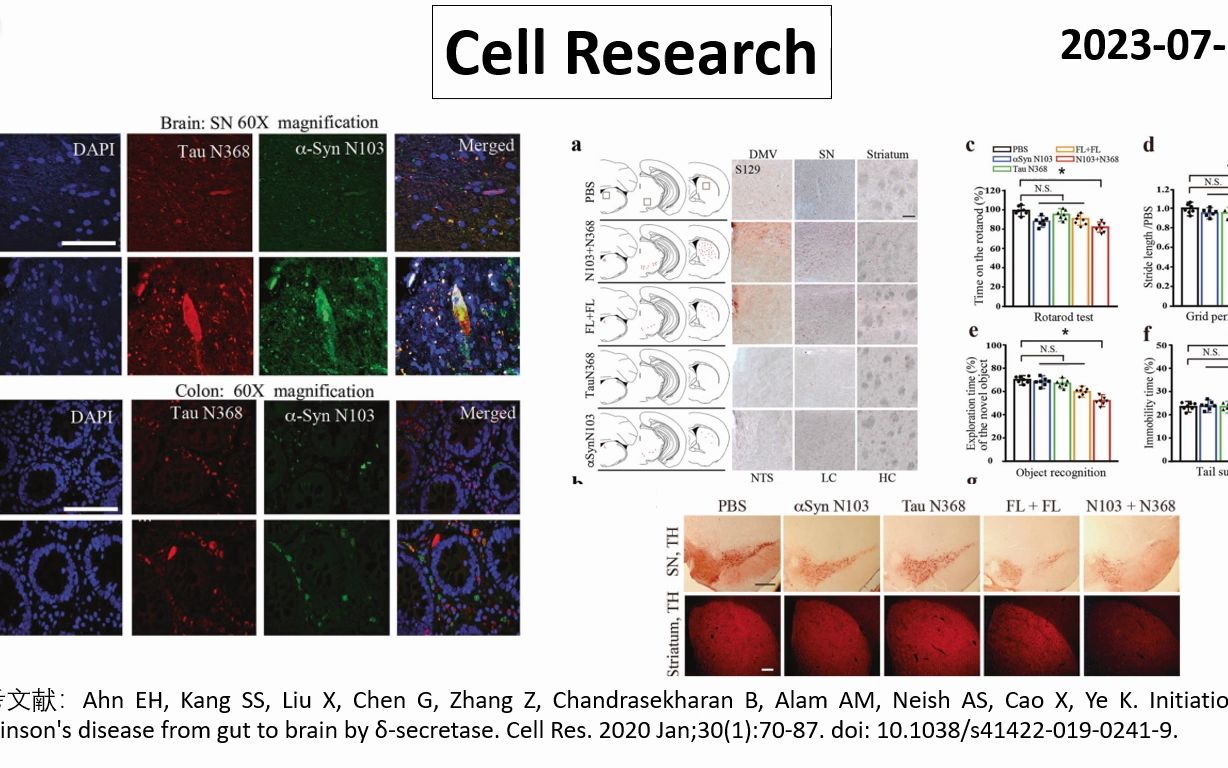 Cell Res—帕金森病是从肠道起源的吗?哔哩哔哩bilibili