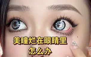 Tải video: 救命！美瞳烂了还能戴吗？