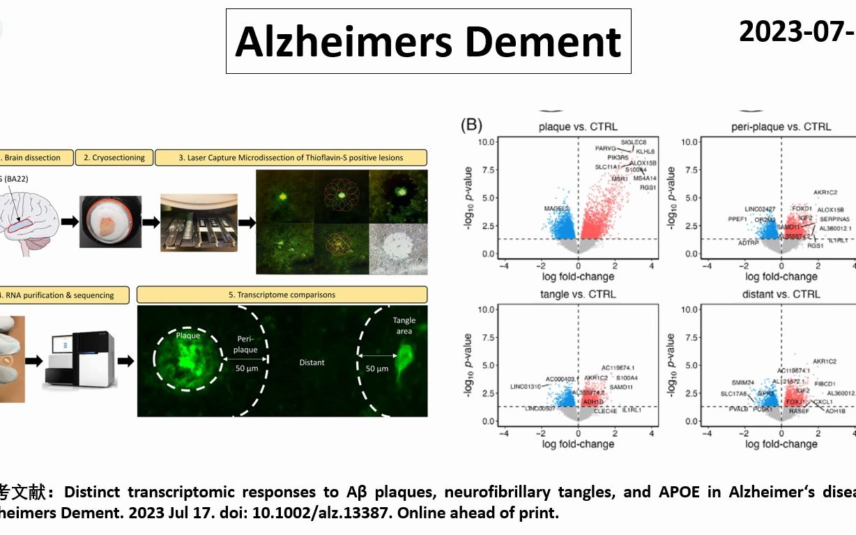 Alzheimers Dement—A‹对大脑基因表达的影响要强于NFT,且受到APOE基因型的调控哔哩哔哩bilibili