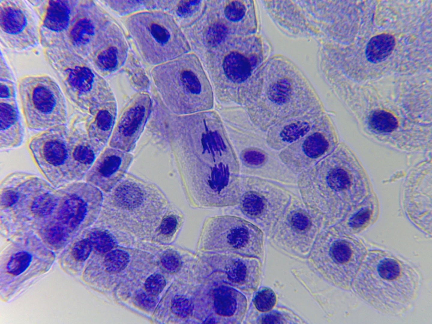 高中生物必修1实验,观察大蒜根尖有丝分裂实验演示,实验结果很不错!哔哩哔哩bilibili