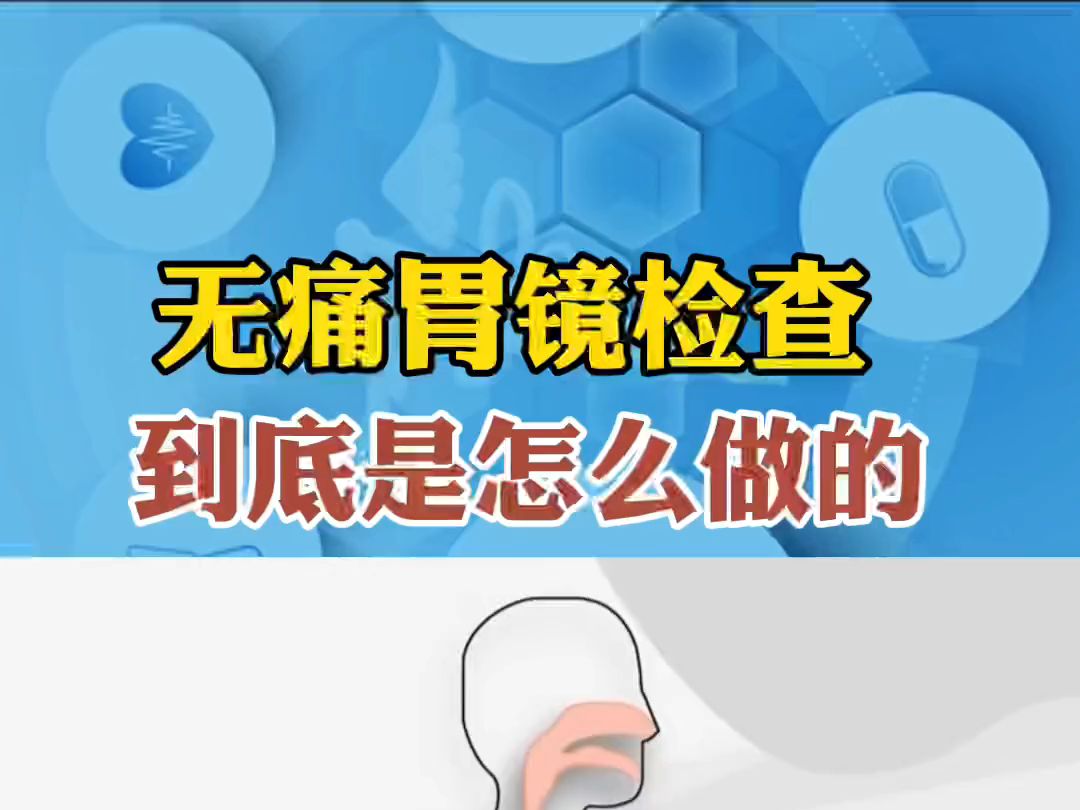 无痛胃镜检查到底是怎么做的?哔哩哔哩bilibili