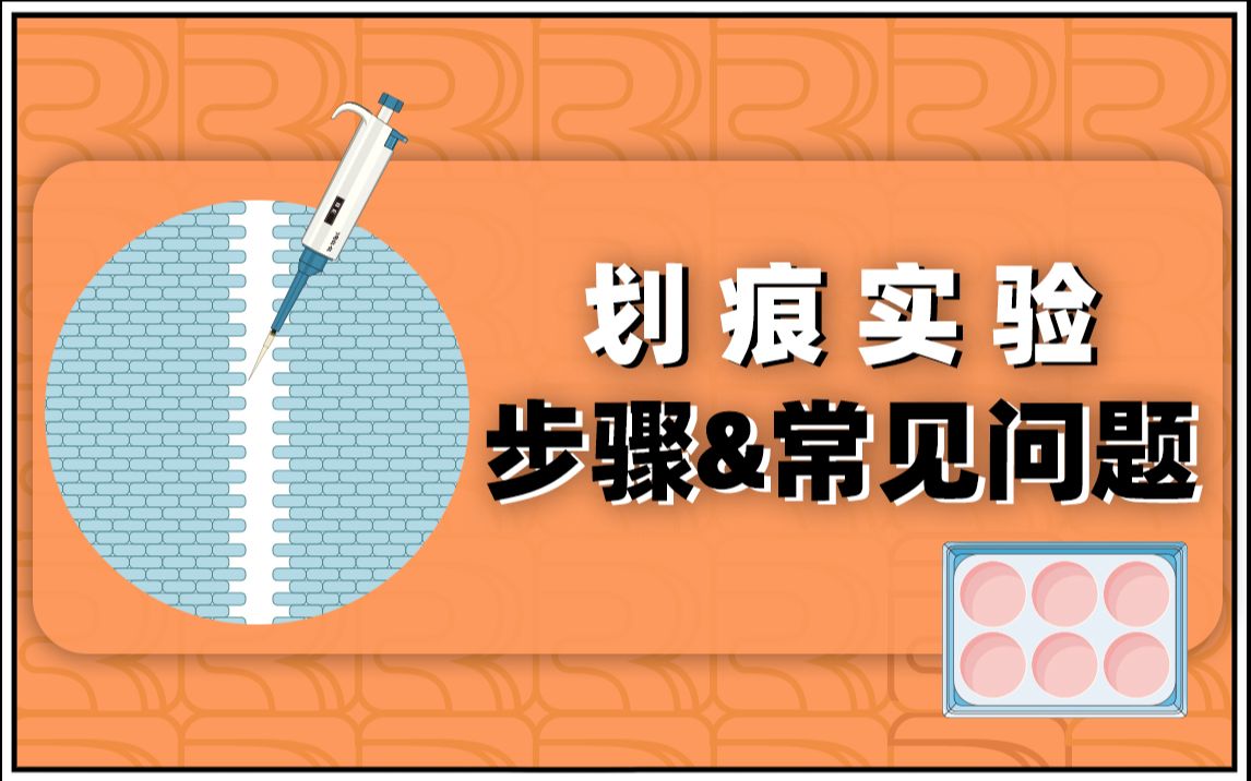 细胞功能实验合集(3):细胞划痕实验 上篇 实验步骤及常见问题哔哩哔哩bilibili