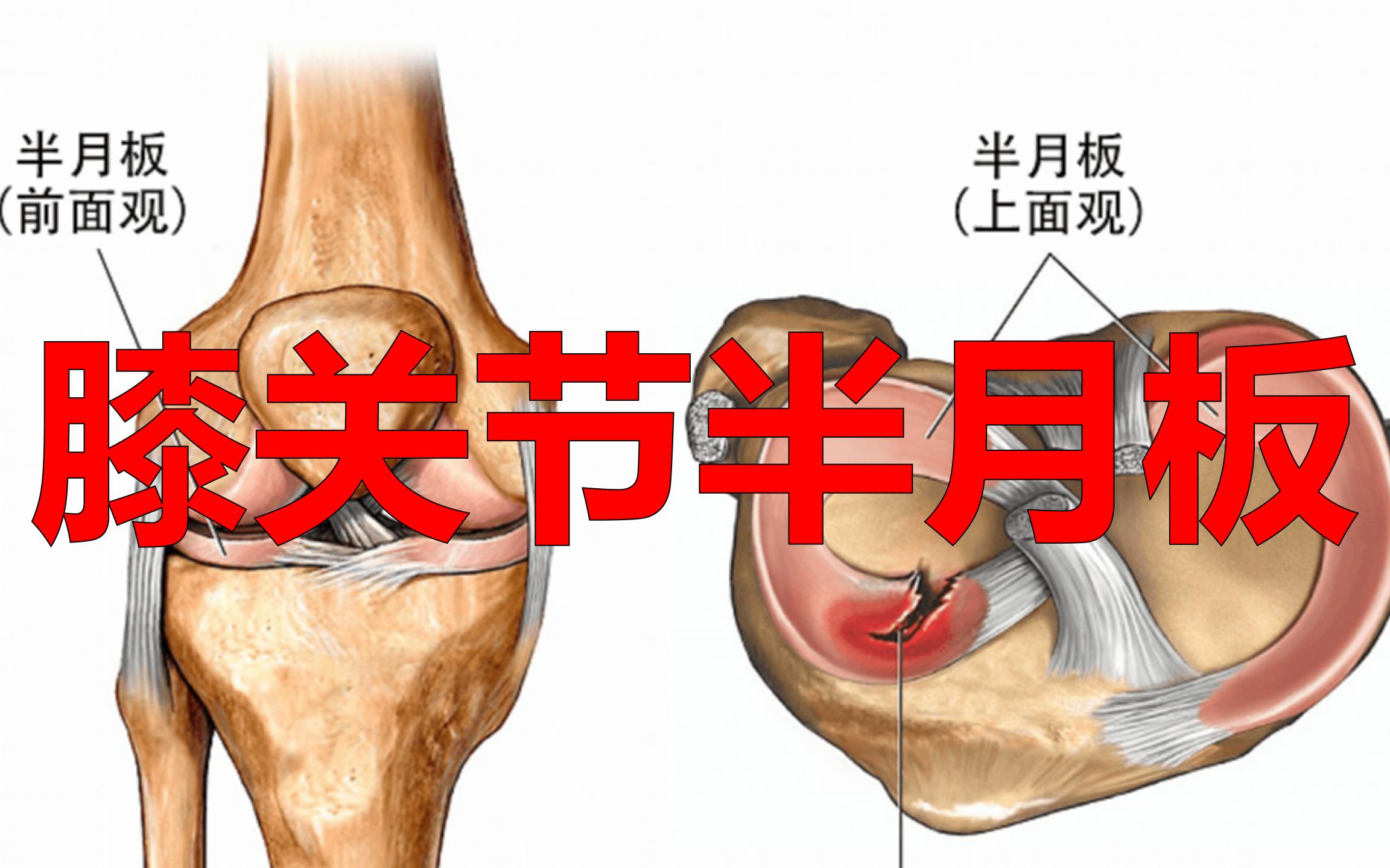 膝关节半月板的特殊构造与功能哔哩哔哩bilibili