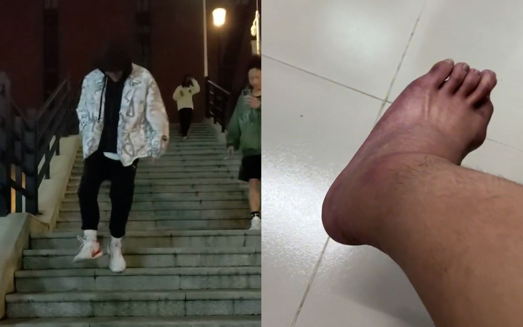 男生打篮球崴了脚,单脚下楼梯时,不料失误连另一只也未幸免