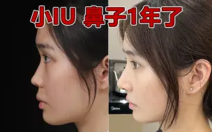 Download Video: 撞见IU的女孩do鼻1年，被无数人奉为模版～