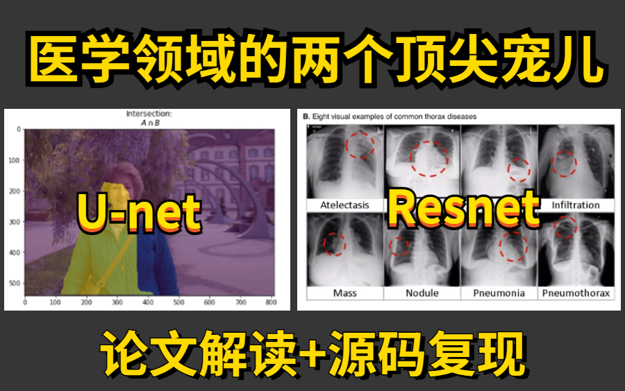 医学领域的两个顶尖宠儿:Transformer+Resnet!医学分割应用与数据集分类实战!论文解读+源码复现,医学界的天花板!哔哩哔哩bilibili