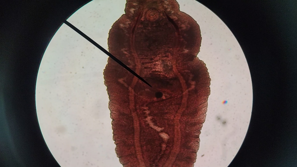 枝睾阔盘吸虫图片