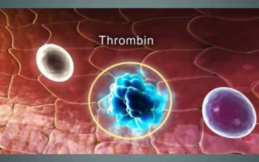3D医学动画:血液凝固的发生机制哔哩哔哩bilibili