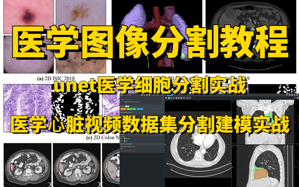 【论文解读+项目实战】2023最有创新的研究方向(医学图像分割教程)分享!计算机博士通俗易懂的讲解,上手极快!哔哩哔哩bilibili