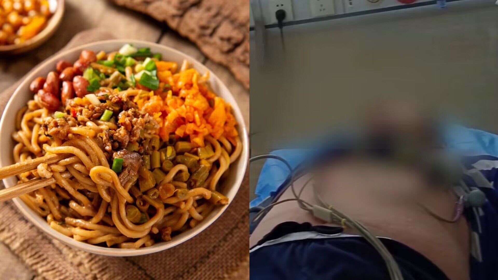 男子食用小麦过敏,全身出现瘙痒,不信邪继续食用连续3次进急诊哔哩哔哩bilibili