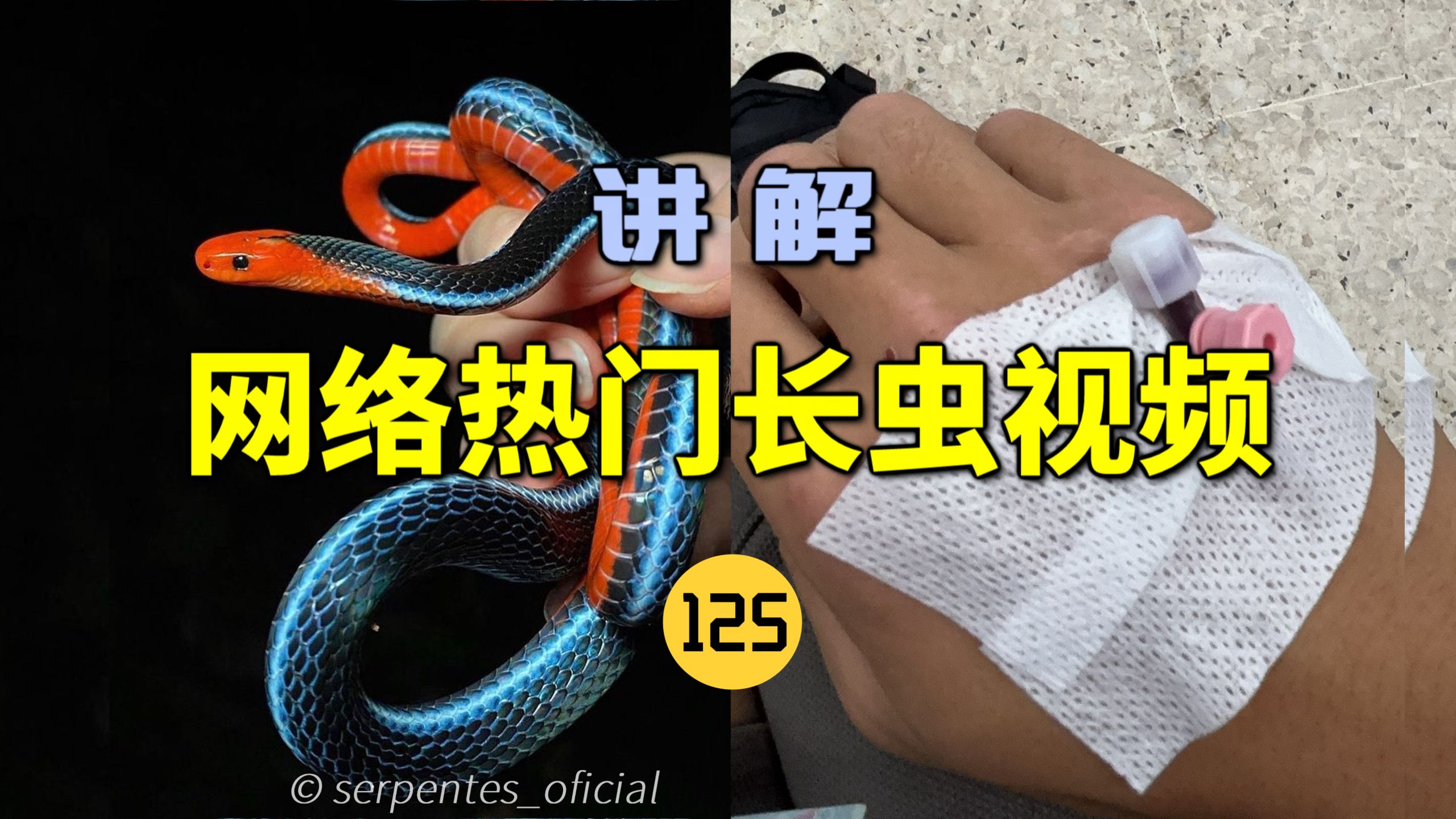 网络热门长虫视频(125)粉丝被“最漂亮毒蛇”咬伤！医生说没有血清？从未见过！