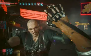 Descargar video: Cyberpunk 2077 狗屁老大汉森给V镇天针灸