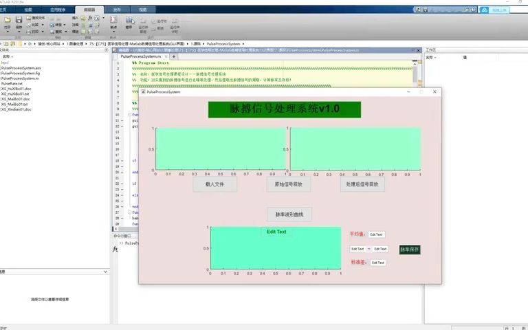 医学信号处理Matlab语言脉搏信号处理系统(GUI界面)1哔哩哔哩bilibili