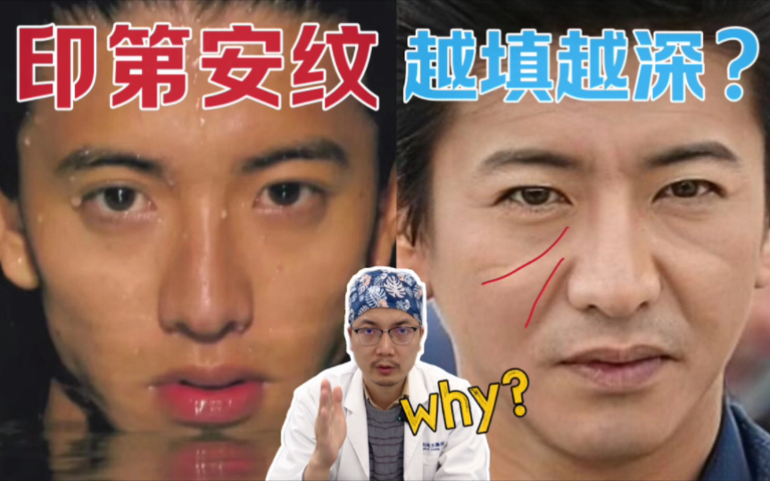 笑起来加深?从解剖聊聊印第安纹的构成原因和改善思路