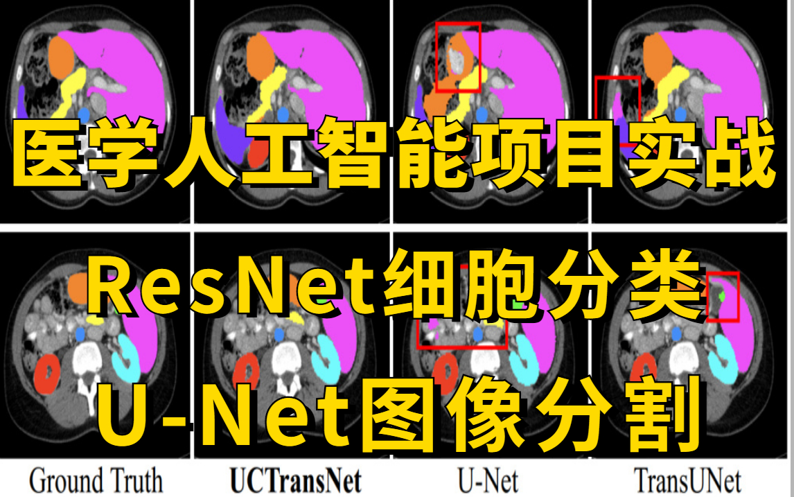 医学人工智能项目实战:基于ResNet网络的细胞分类实战+基于UNet的医学图像分割实战!看完就能跑通!(深度学习/计算机视觉)哔哩哔哩bilibili