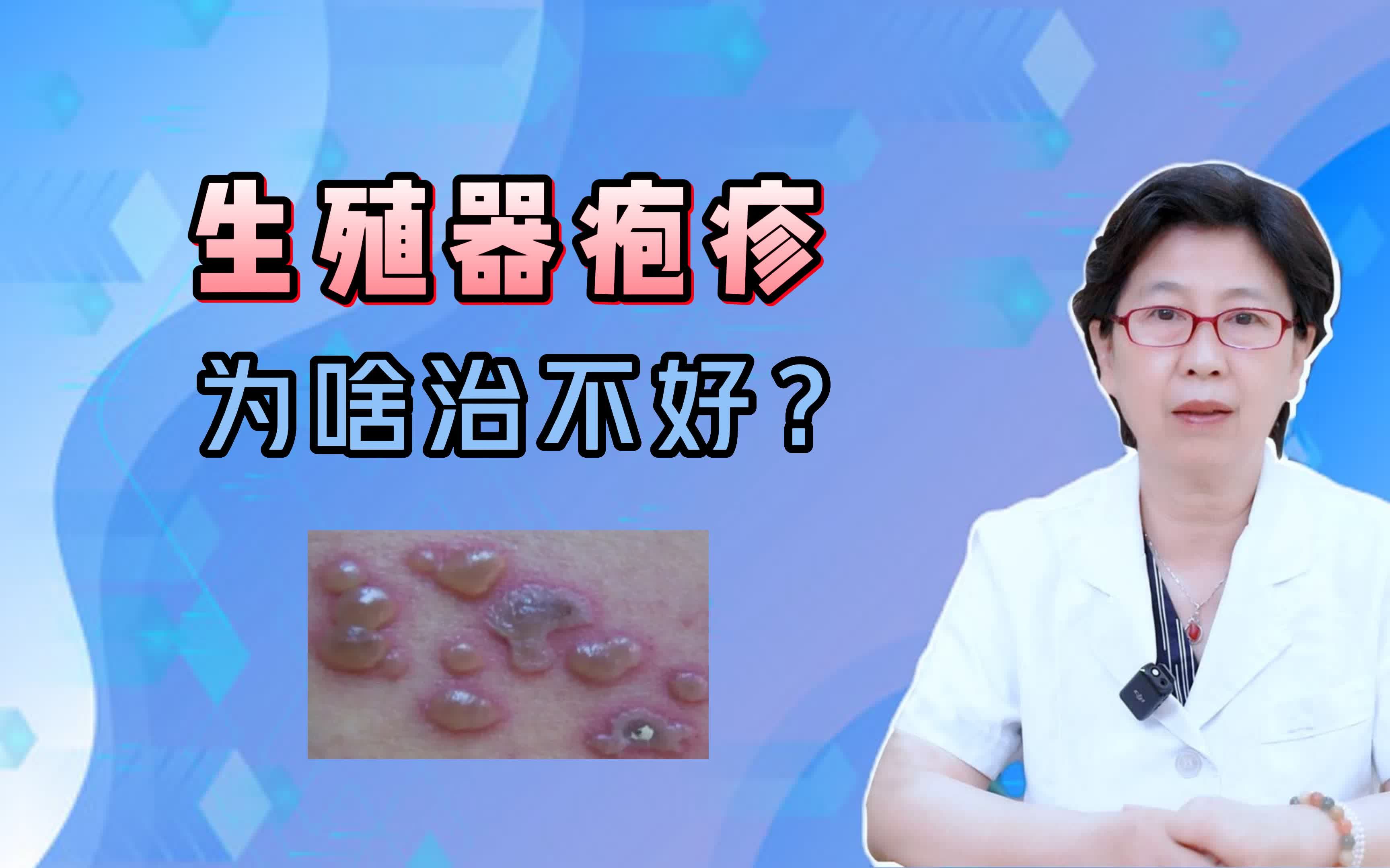 生殖器疱疹, 为啥治不好?哔哩哔哩bilibili