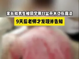 Download Video: 家长称男生被同学用11盆开水烫伤霸凌，9天后老师才发现并告知