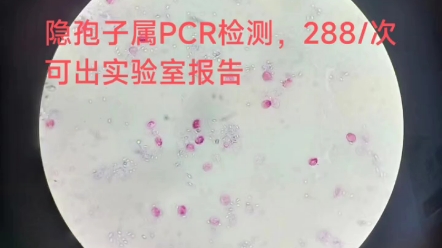 隐孢子虫检测,隐孢子虫镜检蛇隐孢子虫PCR,量大面谈哔哩哔哩bilibili