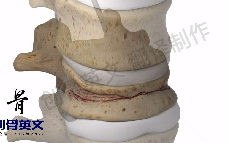 腰椎骨折的骨水泥治疗哔哩哔哩bilibili