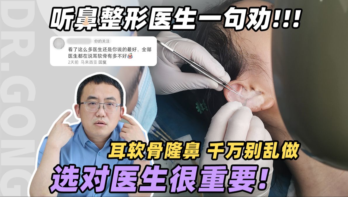 耳软骨隆鼻,千万别乱做!选对医生很重要哔哩哔哩bilibili