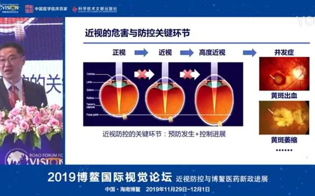 2019博鳌国际视觉论坛【何明光:青少年近视防控,从研究证据到临床实践】哔哩哔哩bilibili