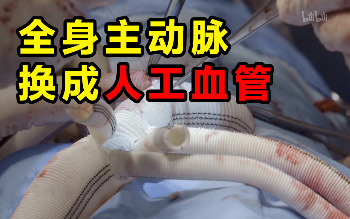 [图]【人间世 第一季】看点1-3：死神代名词，马凡综合征