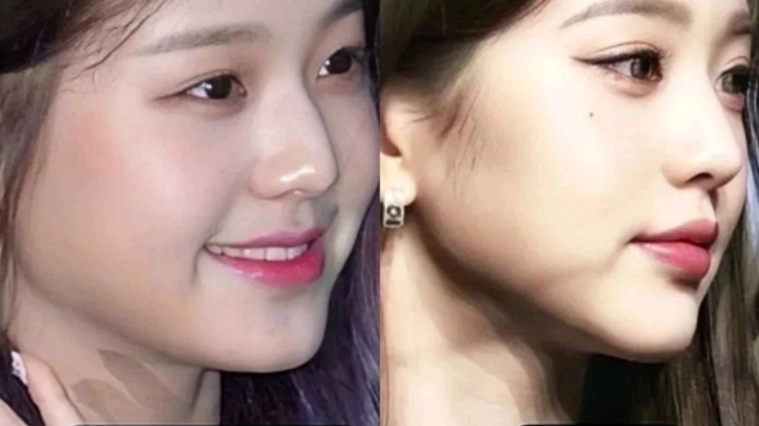 成都燕红丨 人中位置的凹与凸,决定了你的脸是显年轻还是显成熟(上)