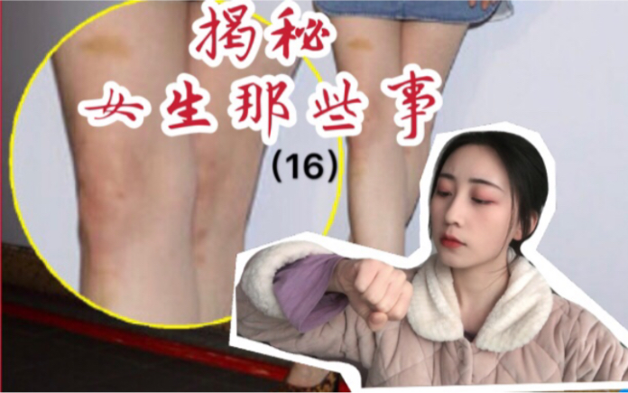 [图]正经知识：女生身上淤青怎么来的？