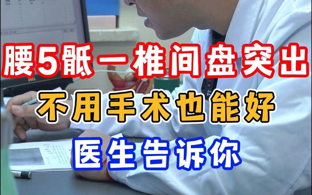 腰5骶一椎间盘突出 不用手术也能好 医生告诉你哔哩哔哩bilibili